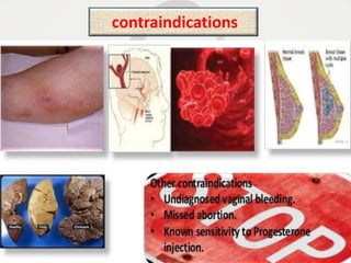contraindications
 