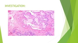 Pneumosclerosis pneumosclerosis | PPTX