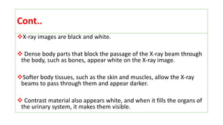 Cont..
X-ray images are black and white.
 Dense body parts that block the passage of the X-ray beam through
the body, such as bones, appear white on the X-ray image.
Softer body tissues, such as the skin and muscles, allow the X-ray
beams to pass through them and appear darker.
 Contrast material also appears white, and when it fills the organs of
the urinary system, it makes them visible.
 