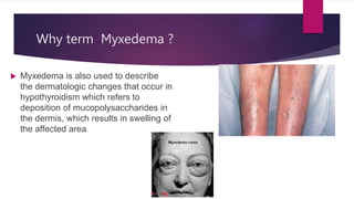 Why term Myxedema ?
 Myxedema is also used to describe
the dermatologic changes that occur in
hypothyroidism which refers to
deposition of mucopolysaccharides in
the dermis, which results in swelling of
the affected area.
 