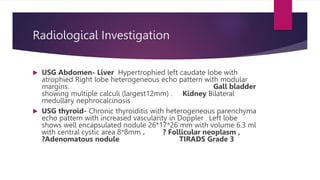 Radiological Investigation
 USG Abdomen- Liver Hypertrophied left caudate lobe with
atrophied Right lobe heterogeneous echo pattern with modular
margins. Gall bladder
showing multiple calculi (largest12mm) . Kidney Bilateral
medullary nephrocalcinosis
 USG thyroid- Chronic thyroiditis with heterogeneous parenchyma
echo pattern with increased vascularity in Doppler . Left lobe
shows well encapsulated nodule 26*17*26 mm with volume 6.3 ml
with central cystic area 8*8mm . ? Follicular neoplasm ,
?Adenomatous nodule TIRADS Grade 3
 