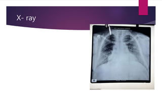 X- ray
 