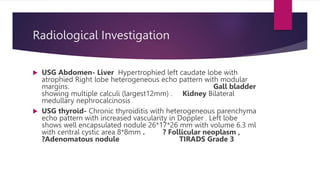 Radiological Investigation
 USG Abdomen- Liver Hypertrophied left caudate lobe with
atrophied Right lobe heterogeneous ec...