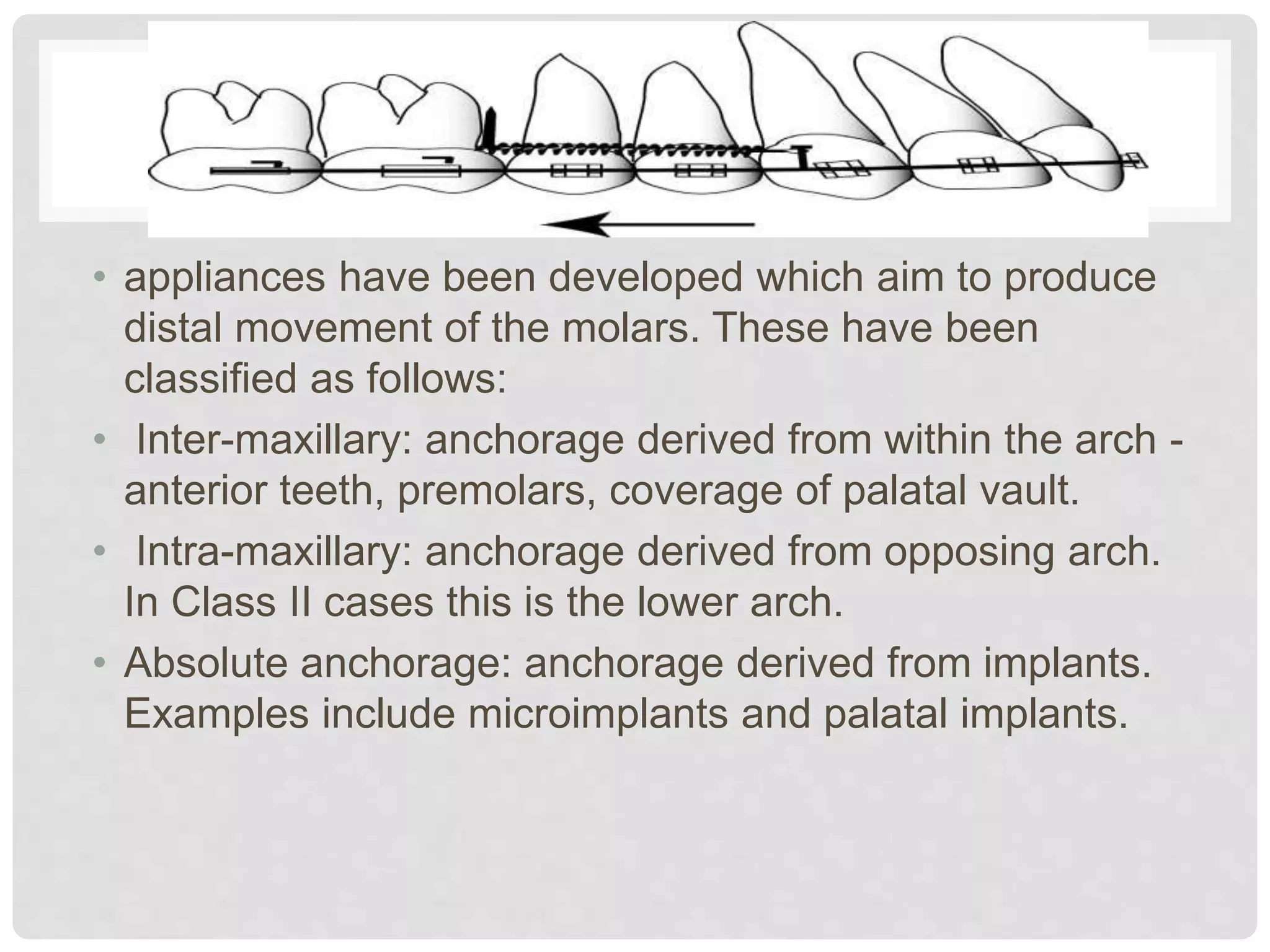 • appliances have been developed which aim to produce
distal movement of the molars. These have been
classified as follows:
• Inter-maxillary: anchorage derived from within the arch -
anterior teeth, premolars, coverage of palatal vault.
• Intra-maxillary: anchorage derived from opposing arch.
In Class II cases this is the lower arch.
• Absolute anchorage: anchorage derived from implants.
Examples include microimplants and palatal implants.
 