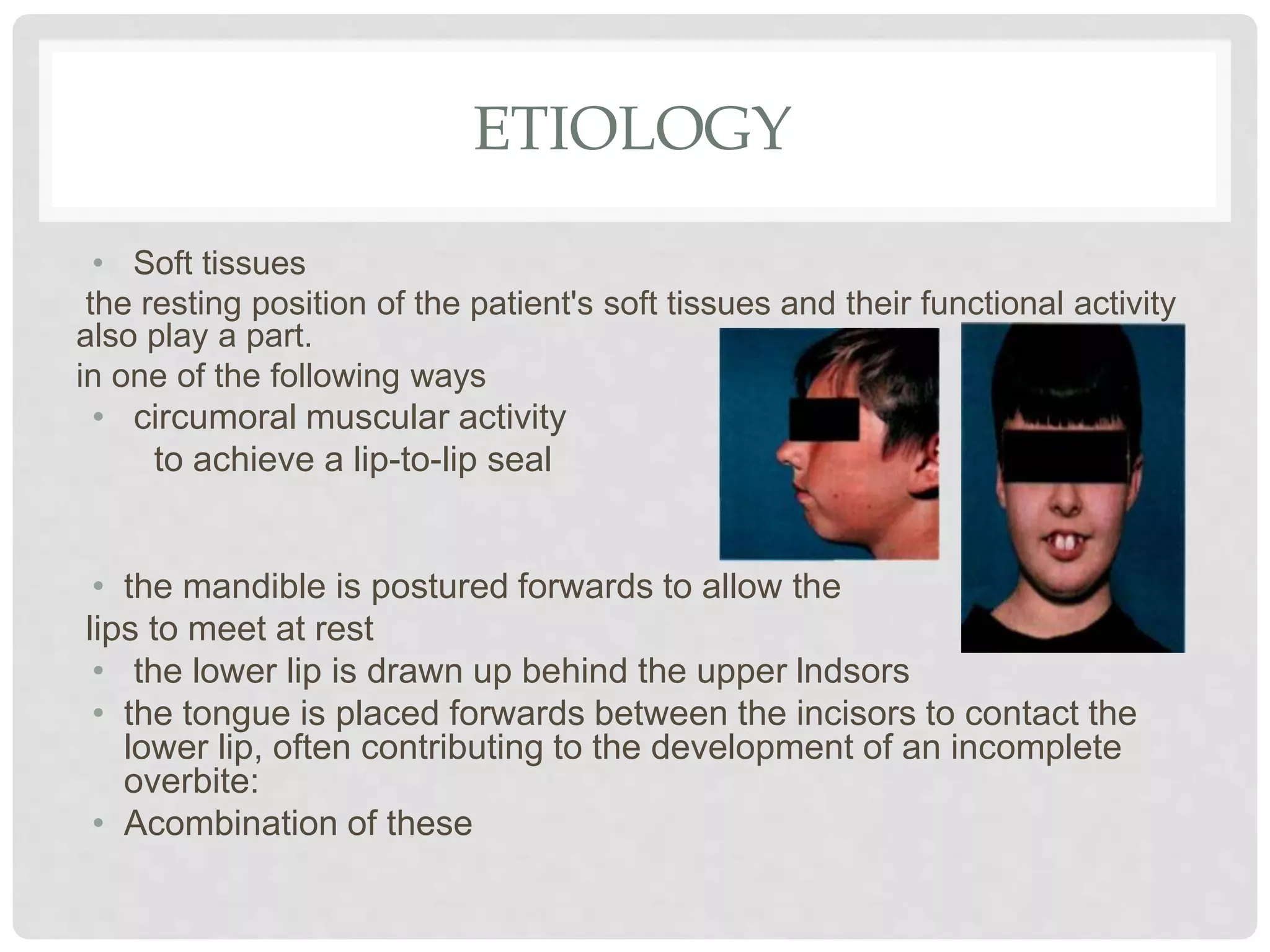 ETIOLOGY
• Soft tissues
the resting position of the patient's soft tissues and their functional activity
also play a part.
in one of the following ways
• circumoral muscular activity
to achieve a lip-to-lip seal
• the mandible is postured forwards to allow the
lips to meet at rest
• the lower lip is drawn up behind the upper lndsors
• the tongue is placed forwards between the incisors to contact the
lower lip, often contributing to the development of an incomplete
overbite:
• Acombination of these
 