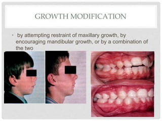 GROWTH MODIFICATION
• by attempting restraint of maxillary growth, by
encouraging mandibular growth, or by a combination of
the two
 
