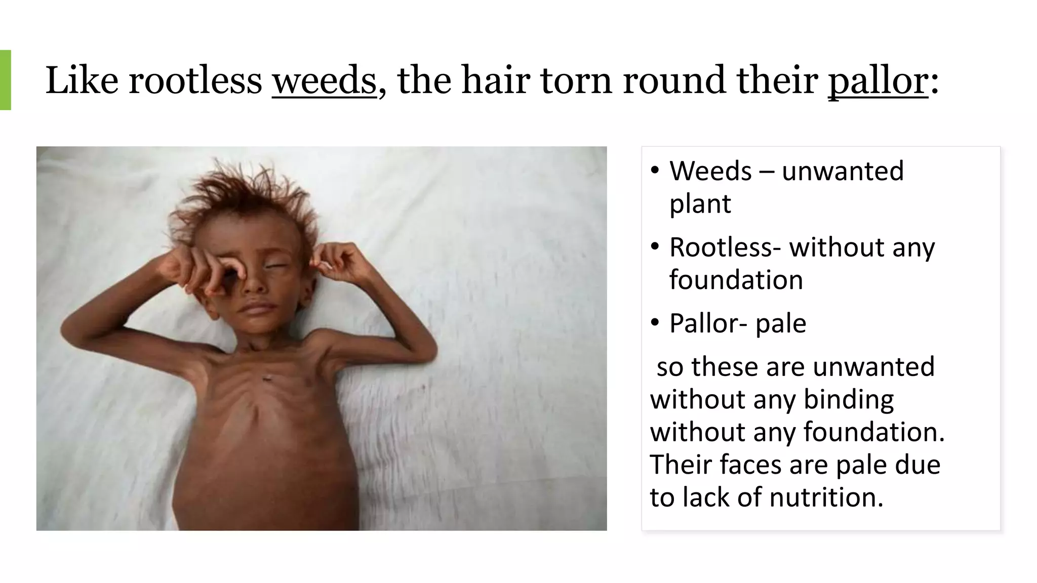 Like rootless weeds, the hair torn round their pallor:
• Weeds – unwanted
plant
• Rootless- without any
foundation
• Pallor- pale
so these are unwanted
without any binding
without any foundation.
Their faces are pale due
to lack of nutrition.
 
