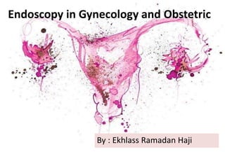 Endoscopy in Gynecology and Obstetric
r
By : Ekhlass Ramadan Haji
 