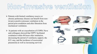 Liberation from mechanical ventilation. | PPTX