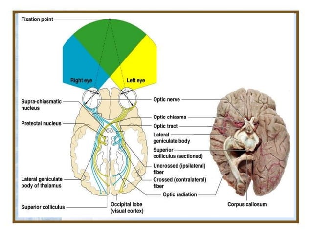 OPTIC NERVE & VISUAL PATHWAY | PPTX | Eye and Vision Conditions ...