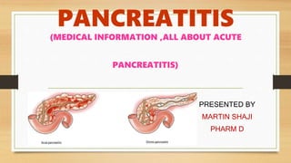 PANCREATITIS
(MEDICAL INFORMATION ,ALL ABOUT ACUTE
PANCREATITIS)
PRESENTED BY
MARTIN SHAJI
PHARM D
 