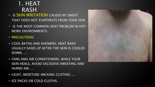 Heatstroke Rash Heat Stroke | PPTX