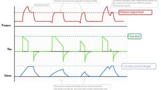 Mechanical Ventilation modes used clinically | PPTX