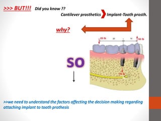 >>> BUT!!! Did you know ??
Cantilever prosthetics Implant-Tooth prosth.
why?
so
 