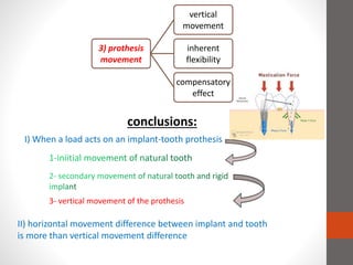 conclusions:
I) When a load acts on an implant-tooth prothesis
3- vertical movement of the prothesis
II) horizontal movement difference between implant and tooth
is more than vertical movement difference
3) prothesis
movement
vertical
movement
inherent
flexibility
compensatory
effect
 