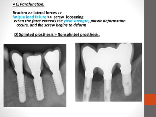  C) Parafunction.
Bruxism >> lateral forces >>
fatigue load failure >> screw loosening
When the force exceeds the yield strength, plastic deformation
occurs, and the screw begins to deform
D) Splinted prosthesis > Nonsplinted prosthesis.
 