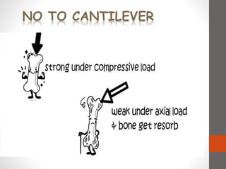 NO TO CANTILEVER
 