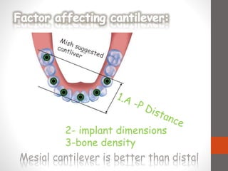 2- implant dimensions
3-bone density
Mesial cantilever is better than distal
 