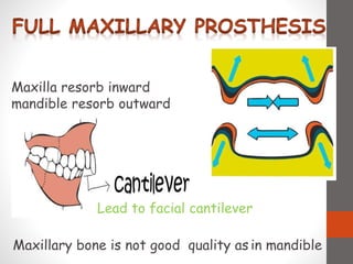 Maxilla resorb inward
mandible resorb outward
Lead to facial cantilever
Maxillary bone is not good quality as in mandible
 