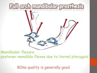 Mandibular flexure
posterior mandible flexes due to iternal pterygoid
BOne quality is generally good
 