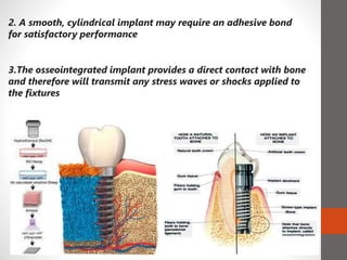 2. A smooth, cylindrical implant may require an adhesive bond
for satisfactory performance
3.The osseointegrated implant provides a direct contact with bone
and therefore will transmit any stress waves or shocks applied to
the fixtures
 