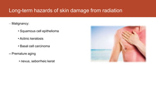Long-term hazards of skin damage from radiation:
– Malignancy:
• Squamous cell epithelioma
• Actinic keratosis
• Basal cell carcinoma
– Premature aging
• nevus, seborrheic kerat
 