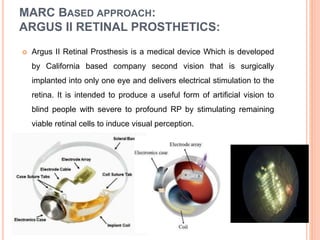 BIONIC EYE | PPTX