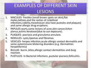 Macule Most Common Example Examination of Skin | PPTX