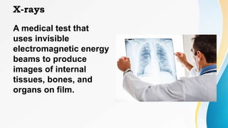 X-rays
A medical test that
uses invisible
electromagnetic energy
beams to produce
images of internal
tissues, bones, and
organs on film.
 