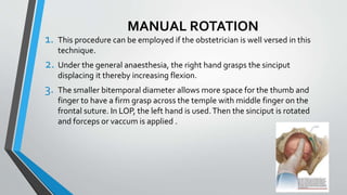 MANUAL ROTATION
1. This procedure can be employed if the obstetrician is well versed in this
technique.
2. Under the general anaesthesia, the right hand grasps the sinciput
displacing it thereby increasing flexion.
3. The smaller bitemporal diameter allows more space for the thumb and
finger to have a firm grasp across the temple with middle finger on the
frontal suture. In LOP, the left hand is used.Then the sinciput is rotated
and forceps or vaccum is applied .
 