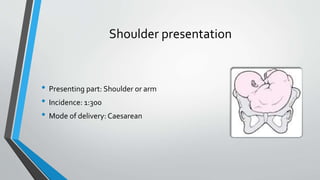 Shoulder presentation
• Presenting part: Shoulder or arm
• Incidence: 1:300
• Mode of delivery: Caesarean
 