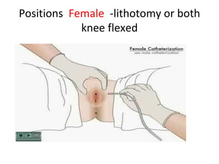 Positions Female -lithotomy or both
knee flexed
 