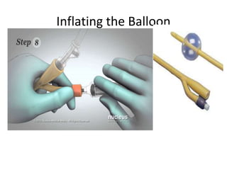 Inflating the Balloon
 