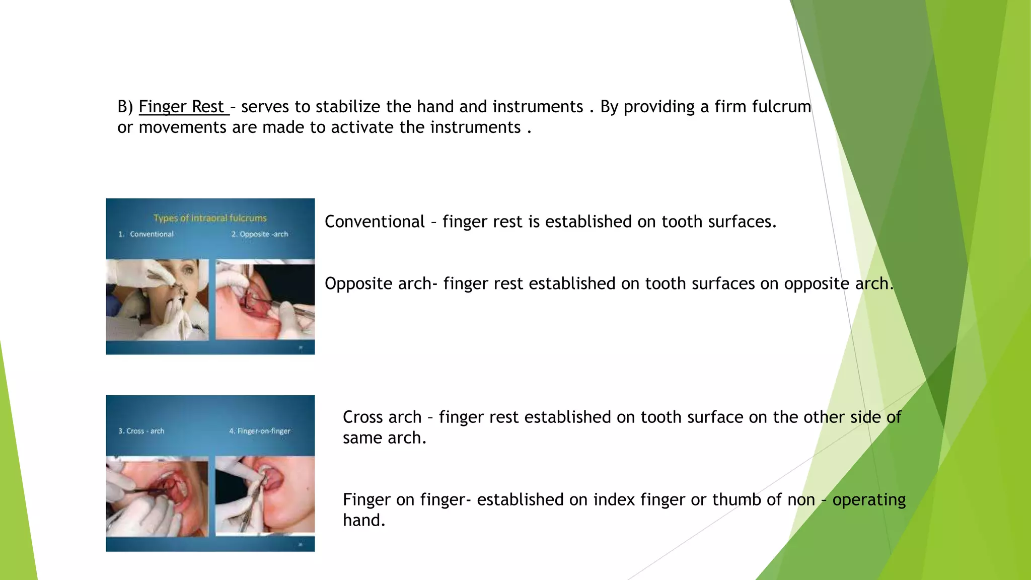Conventional – finger rest is established on tooth surfaces.
Opposite arch- finger rest established on tooth surfaces on opposite arch.
Cross arch – finger rest established on tooth surface on the other side of
same arch.
Finger on finger- established on index finger or thumb of non – operating
hand.
B) Finger Rest – serves to stabilize the hand and instruments . By providing a firm fulcrum
or movements are made to activate the instruments .
 