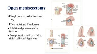 Meniscus injury for postgraduate | PPTX