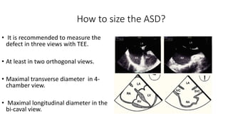Measure Rims Asd Mri Presentation1.pdf