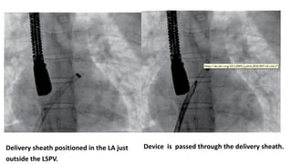 Presentation1.pdf