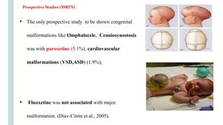 • The only prospective study to be shown congenital
malformations like Omphalocele, Craniosynostosis
was with paroxetine (5.1%), cardiovascular
malformations (VSD,ASD) (1.9%);
• Fluoxetine was not associated with major
malformation. (Diav-Citrin et al., 2005).
ProspectiveStudies(SSRI’S)
 