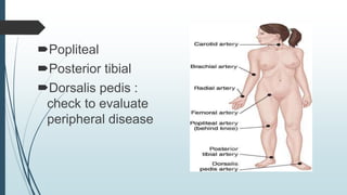 Popliteal
Posterior tibial
Dorsalis pedis :
check to evaluate
peripheral disease
 