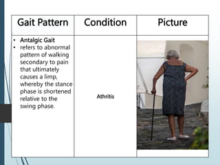Gait Pattern Condition Picture
• Antalgic Gait
• refers to abnormal
pattern of walking
secondary to pain
that ultimately
causes a limp,
whereby the stance
phase is shortened
relative to the
swing phase.
Athritis
 