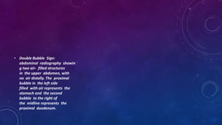 • Double Bubble Sign:
abdominal radiography showin
g two air- filled structures
in the upper abdomen, with
no air distally. The proximal
bubble in the left side
filled with air represents the
stomach and the second
bubble to the right of
the midline represents the
proximal duodenum.
 