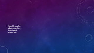 • Toxic Megacolon
Abdominal X-ray -
large bowel
obstruction.
 