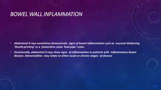 BOWEL WALL INFLAMMATION
• Abdominal X-rays sometimes demonstrate signs of bowel inflammation such as mucosal thickening
'thumb-printing' or a featureless colon 'lead pipe' colon.
• Occasionally, abdominal X-rays show signs of inflammation in patients with inflammatory bowel
disease. Abnormalities may relate to either acute or chronic stages of disease
 