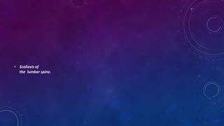 • Scoliosis of
the lumbar spine.
 