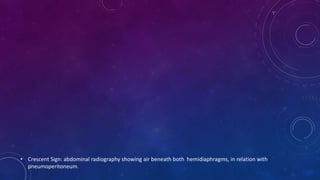 • Crescent Sign: abdominal radiography showing air beneath both hemidiaphragms, in relation with
pneumoperitoneum.
 