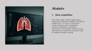 Modules
1. Data Acquisition:
This initial stage involves gathering a
substantial and diverse dataset of medical
images (e.g., CT scans, X-rays) from
various sources such as hospitals,
research institutions, and public
repositories. The dataset should include
both cancerous and non-cancerous cases
for effective model training.
 