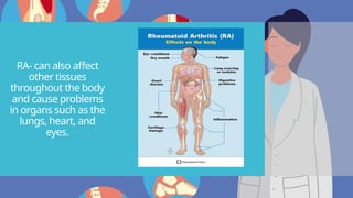 RA- can also affect
other tissues
throughout the body
and cause problems
in organs such as the
lungs, heart, and
eyes.
 