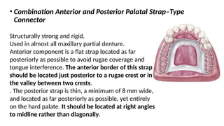Maxillary major connector (removable partial denture ) | PPTX