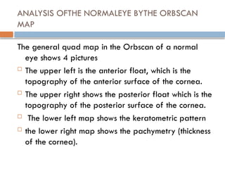 Posterior Float Topography and tomography in ophthalmology | PPTX