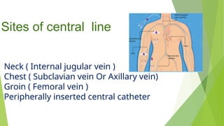 Presentation on Central line associated bloodstream infection | PPTX